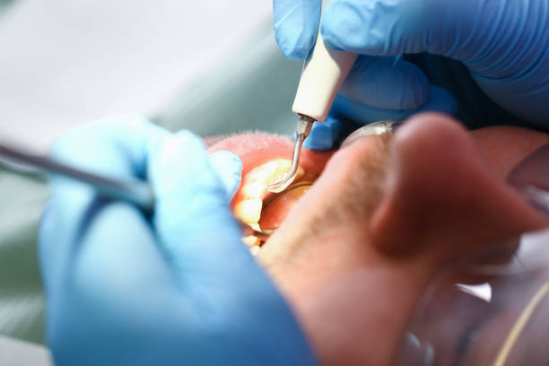 Best Tooth Infection Emergency Dentist  in Holiday, FL